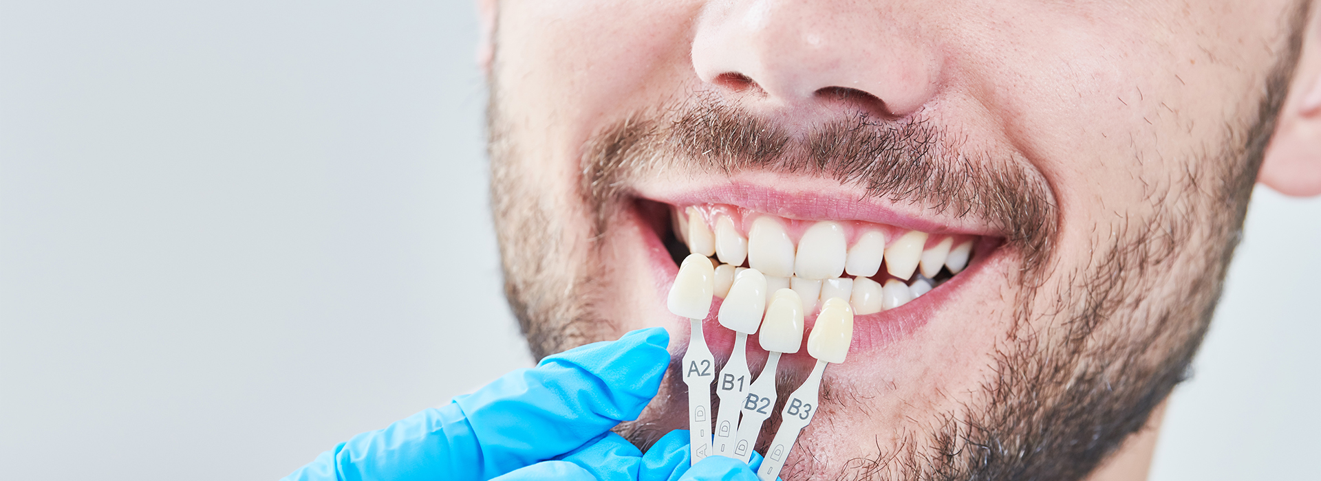 Dental Implants Dentist Vista CA